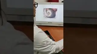 Lesiones VPH en C&eacute;rvix