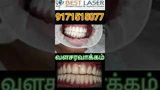 Age not a problem to get full set of new teeth with dentalImplant -best laser Chennai India!#shorts