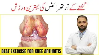 What is the Best Exercise for Knee Arthritis | Top 5 Low-Impact Exercises for Knee Pain | Arthritis