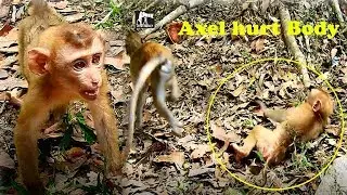 So sad see poor Axel hurt full body after Big abandon pigtail monkey bite this evening