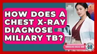 How Does A Chest X-ray Diagnose Miliary TB? - Tuberculosis Disease Guide