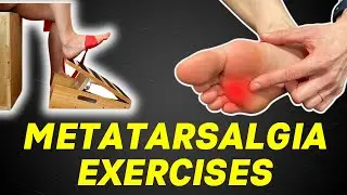 Упражнения при метатарзалгии | Лечение метатарзалгии дома у специалиста по лечению стоп