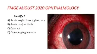 FMGE AUGUST 2020 EXAM  OPHTHALMOLOGY FMGE RECALL MCQ   Image Based Question | #Dr.clinical #FMGE