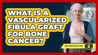 What Is A Vascularized Fibula Graft For Bone Cancer? - Bone Cancer Relief Guide