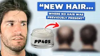 PP405: Regrows Hair In 8 Weeks. Is This The Miracle Cure?