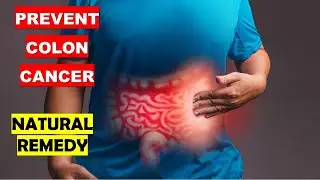 Colon Cancer Prevention | Colon Health | Cause of Colon Cancer | Foods to Avoid |