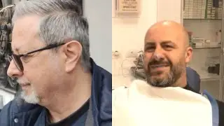 Cure dentali in Albania, Antonio monta i definitivi. Nuovo look per Tino: 