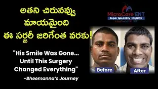అతని చిరునవ్వు మాయమైంది ఈ సర్జరీ జరిగేంత వరకు? | Bheemanna&rsquo;s Journey | Dr. Sriprakash Vinnakota