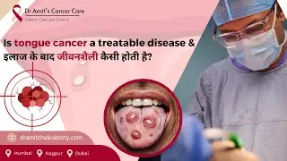 Tongue cancer का इलाज योग्य और ठीक होने योग्य है & और surgery के बाद जीवनशैली | Dr. Amit Chakraborty