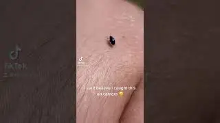 Bug poop