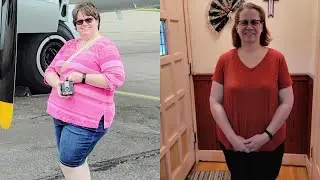 Couple Achieves Significant Weight Loss Without Surgery | Sanford Health News