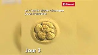 FIV ICSI : d&eacute;veloppement de l'embryon