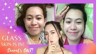 How did I got rid of my pimples? + KOREAN GLASS SKIN ACHIEVED + SECRET NO MORE !! | Anne Llamoso