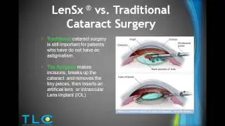TLC Eye Care Webinar - Dr. Sujata Purohit