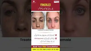 Say Goodbye to Skin Imperfections!At Health 360#Health360#FlawlessSkin #FDAApproved #SkinCareExperts