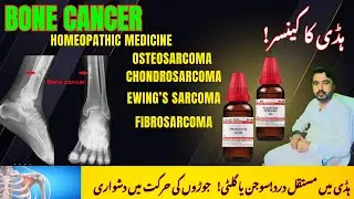 Bone Cancer: Causes Symptoms & Treatment!#Bone Cancer Symptoms#bone cancer best medicine @homeoTec