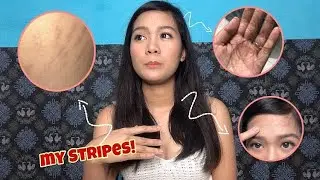 5 BODY CHANGES AFTER HAVING A BABY 💕 | MaryKane Vlogs