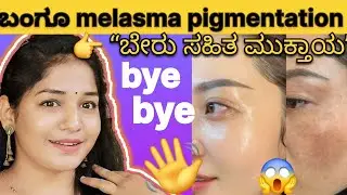 ಬಂಗೂ 😱 dark  ಸ್ಪಾಟ್ ಸಮಸ್ಯೆ? ಹೈಪರ್ ಪಿಗ್ಮೆಂಟೇಶನ್ ಪರಿಹಾರ ಮನೆಲ್ಲೇ 👉 “ಬೇರು ಸಹಿತ ಮುಕ್ತಾಯ”