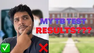 How to Apply for UK Medical Test for Student Visa || Full Medicals Process || HeramPadala