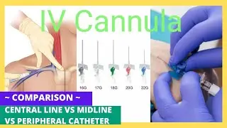 IV Cannula || Peripheral vs Central line vs Midline Cannula ||Tips to remember size || Pharma-Scope