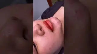 Kỹ thuật nano cấy m&agrave;u candylip hiệu ứng son dưỡng c&oacute; m&agrave;u