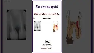 Why are root canals irrigated? #dentistry #shorts