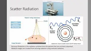 X-ray Low Dose Digital Imaging