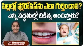 How To Identify Fluorosis In Childrens Teeth? | Dental Implant Treatment | Eledent Dental Hospitals