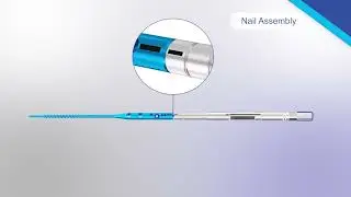 Flex-Thread Fibula Nail Animation