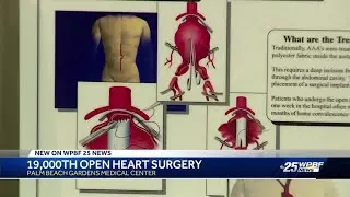 Palm Beach Gardens Medical Center celebrates milestone of operating more than 19k open-heart surg...
