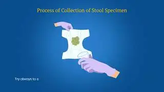 Stool Specimen Collection AFP Surveillance