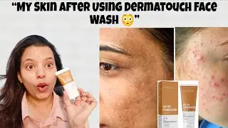 DERMATOUCH FACE WASH ( Pigmentation and Dark spots ) ✨