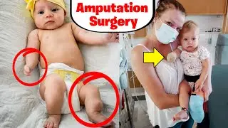 Sister Wives Maddie Brown Daughter Undergoes Amputation Surgery