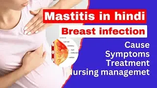 Mastitis in hindi | breast infection symptoms | cause, symptoms, treatment | nursing lecture hindi