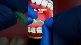 Which is the best type of wedge for Class II restorations?