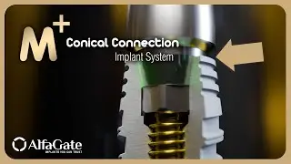 M Plus conical connection Implant, Superior Primary Stability