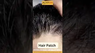 Best Hair Patch Service in Delhi