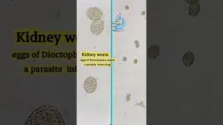 Dioctophyma renale (kidney worm) eggs