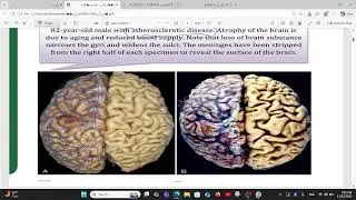 شرح ومراجعة العملي والنضري م 1 باثلوجي علم الامراض العام