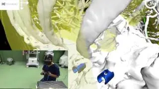 Virtual reality (VR) based simulators for spine surgery