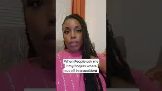 Missing fingers #differentlyabled #disability #relationship #host #shortvideo shor#short #trending
