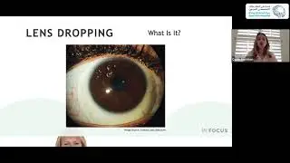 Scleral Lenses: Managing Common Fitting Issues and Complications