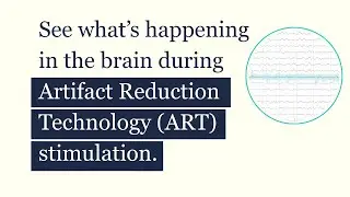 How Artifact Reduction Technology (ART) Helps Reveal EEG Biomarkers in the BTS System