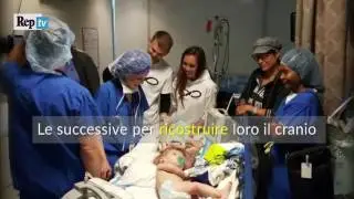 Gemelli siamesi separati: l'emozione dei genitori dopo 27 ore di operazione alla testa