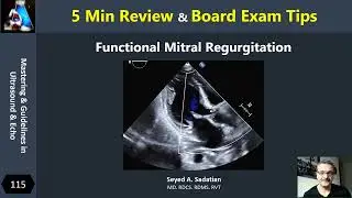 5 Min Review : Functional Mitral Regurgitation