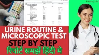 Urine routine test | Step by Step | रिपोर्ट हिंदी मे समझे | urine microscopic examination | #urine 