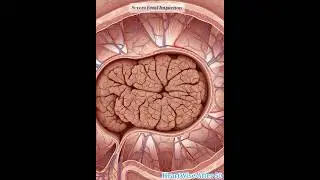Realistic Colon Animation of Fecal Impaction #shorts #youtubeshorts #guthealth #animation