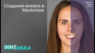Meshmixer создание цифрового Digital wax up и печать на 3d SLA Form Labs 2