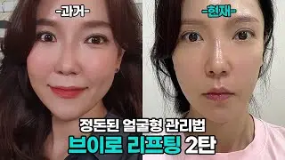 여배우들이 하는 리프팅?! 지금까지 했던 모든 탄력레이저 다 알려드림(feat. 피부과30년짬바)