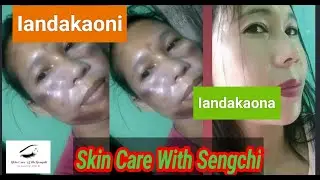Best Skin care routine/what is the best care for skin/what are the 5 basic of skin care/skin  care